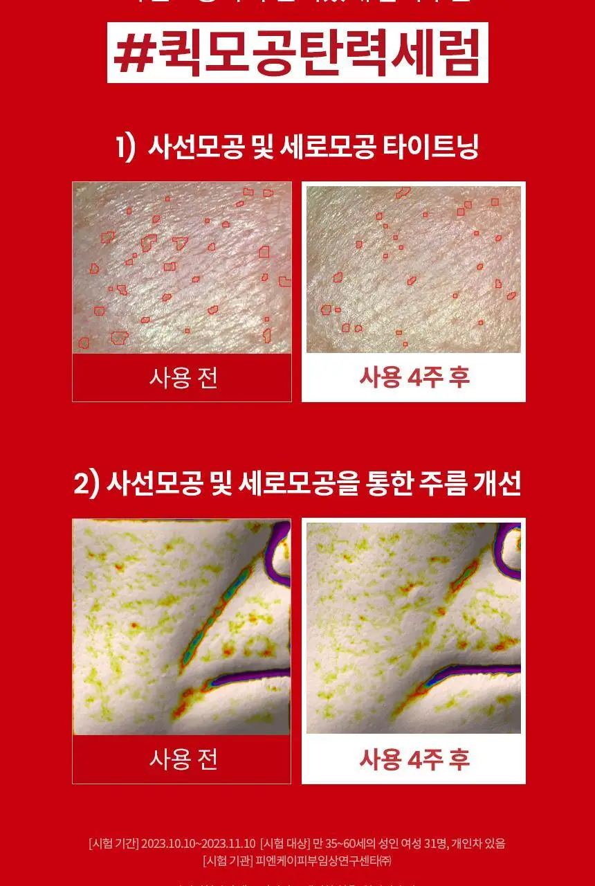 [단독기획/리프팅]AHC 프로 샷 콜라 쥬비네이션 리프팅 세럼 40ml 기획 (+아이크림 10ml) 상세페이지 11
